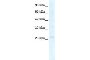 WB Suggested Anti-SOX14 Antibody Titration:  2. (SOX14 抗体  (Middle Region))