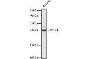 Western blot analysis of extracts of Rat eye using CPLX4 Polyclonal Antibody at dilution of 1:3000. (Complexin 4 抗体)