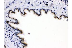 IHC testing of FFPE rat lung with ARSA antibody. (Arylsulfatase A 抗体)
