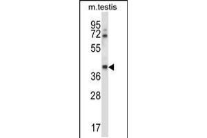 Western blot analysis in mouse testis tissue lysates (35ug/lane). (CSNK1G1 抗体  (C-Term))