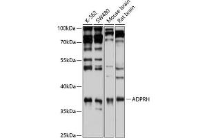 Western blot analysis of extracts of various cell lines, using ADPRH antibody (ABIN6129880, ABIN6136587, ABIN6136588 and ABIN6221872) at 1:1000 dilution. (ADPRH 抗体  (AA 180-270))