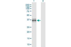 Western Blot analysis of IGFBP3 expression in transfected 293T cell line by IGFBP3 monoclonal antibody (M02), clone 2G6.