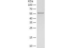 Western Blotting (WB) image for phosphoglycerate Dehydrogenase (PHGDH) (AA 1-533) protein (His tag) (ABIN7284424) (PHGDH Protein (AA 1-533) (His tag))