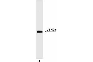 Western blot analysis of p53. (p53 抗体  (AA 14-289))
