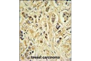 Immunohistochemistry (Paraffin-embedded Sections) (IHC (p)) image for anti-Zinc Finger Protein 202 (ZNF202) (AA 342-370) antibody (ABIN653731)