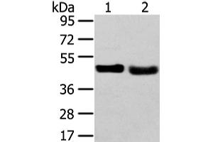 Western Blot analysis of 231 cell and Human fetal liver tissue using TRIB2 Polyclonal Antibody at dilution of 1/450 (TRIB2 抗体)