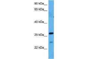Host:  Rabbit  Target Name:  GJB1  Sample Tissue:  Mouse Spleen  Antibody Dilution:  1ug/ml (GJB1 抗体  (Middle Region))