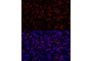Immunofluorescence (IF) image for anti-Programmed Cell Death 1 (PDCD1) (AA 1-100) antibody (ABIN7269537)