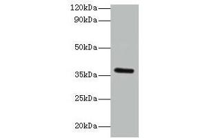 Western blot All lanes: BRCC3 antibody at 2 μg/mL + K562 whole cell lysate Secondary Goat polyclonal to rabbit IgG at 1/15000 dilution Predicted band size: 37, 34, 24, 29 kDa Observed band size: 37 kDa (BRCC3 抗体  (AA 14-316))