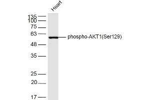 Mouse heart lysates probed with AKT1(Ser129) Polyclonal Antibody, Unconjugated  at 1:300 dilution and 4˚C overnight incubation. (AKT1 抗体  (pSer129))