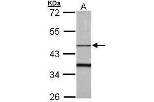 WB Image Sample (30 ug of whole cell lysate) A: Raji 10% SDS PAGE antibody diluted at 1:1000 (FBXO15 抗体)