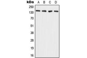 Western blot analysis of ADAMTS2 expression in A431 (A), MCF7 (B), SP2/0 (C), H9C2 (D) whole cell lysates.