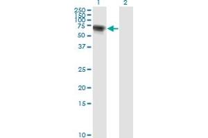 Western Blotting (WB) image for anti-RRIO Kinase 3 (RIOK3) (AA 1-516) antibody (ABIN563783)