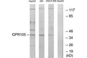 Western blot analysis of extracts from 293/COLO205/HepG2 cells, using GPR105 Antibody. (P2RY14 抗体  (AA 146-195))