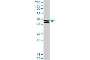 Western Blotting (WB) image for anti-Carboxypeptidase A1 (Pancreatic) (CPA1) (AA 1-419) antibody (ABIN514541)