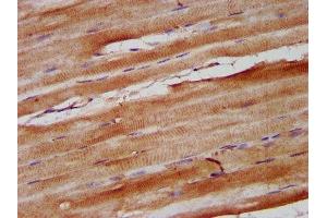 IHC image of ABIN7161101 diluted at 1:600 and staining in paraffin-embedded human skeletal muscle tissue performed on a Leica BondTM system. (Nebulin 抗体  (AA 245-373))