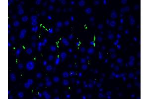 ABIN6267554 at 1/200 staining human gastric tissue sections by ICC/IF. (LIM Domain Kinase 1 抗体  (pThr508))
