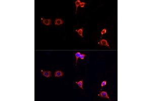 Immunofluorescence analysis of PC12 cells using MTOR antibody. (MTOR 抗体  (AA 2388-2487))