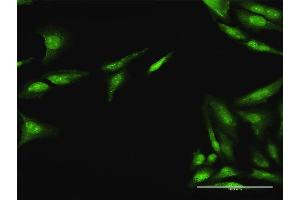 Immunofluorescence of purified MaxPab antibody to CDC25A on HeLa cell.