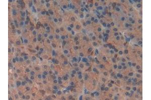 Immunohistochemistry (IHC) image for anti-Vasoactive Intestinal Peptide (Vip) (AA 34-157) antibody (ABIN7431701)