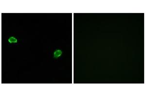 Immunofluorescence analysis of MCF-7 cells, using OR5M3 antibody. (OR5M3 抗体  (Internal Region))