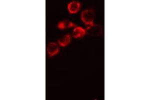 ABIN6266687 staining MCF-7 cells by IF/ICC. (DLGAP1 抗体  (Internal Region))