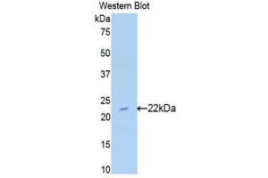 Western Blotting (WB) image for anti-Sulfite Oxidase (SUOX) (AA 89-270) antibody (ABIN1176602) (SUOX 抗体  (AA 89-270))