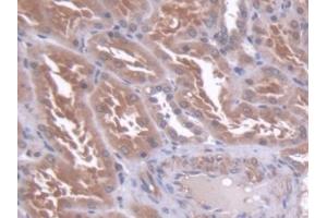 Detection of CBFb in Human Kidney Tissue using Polyclonal Antibody to Core Binding Factor Beta Subunit (CBFb)