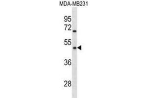 Western Blotting (WB) image for anti-Olfactory Receptor 1Q1 (OR1Q1) antibody (ABIN3000764) (OR1Q1 抗体)