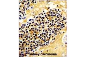 Immunohistochemistry (Paraffin-embedded Sections) (IHC (p)) image for anti-Killer Cell Lectin-Like Receptor Subfamily C, Member 1 (KLRC1) (AA 180-206), (C-Term) antibody (ABIN652569)