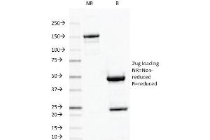 SDS-PAGE Analysis Purified ODC1 MAb (ODC1/487). (ODC1 抗体)