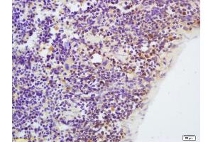 Formalin-fixed and paraffin embedded mouse spleen labeled with Anti-CKLF Polyclonal Antibody, Unconjugated (ABIN739650) at 1:200, followed by conjugation to the secondary antibody and DAB staining (CKLF 抗体  (AA 1-100))