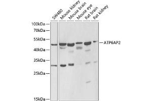 Western Blotting (WB) image for anti-ATPase, H+ Transporting, Lysosomal Accessory Protein 2 (ATP6AP2) (AA 251-350) antibody (ABIN6137342)