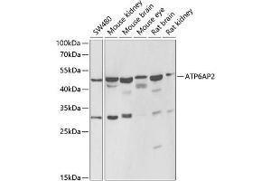 Western blot analysis of extracts of various cell lines, using  antibody (ABIN6129200, ABIN6137342, ABIN6137343 and ABIN6222191) at 1:1000 dilution. (ATP6AP2 抗体  (AA 251-350))