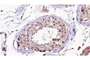 ABIN6275326 at 1/100 staining human testis tissue sections by IHC-P. (NUSAP1 抗体  (C-Term))
