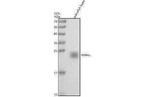 Western blot analysis of RAB4a using anti-RAB4a antibody (AZQ6PHI9).