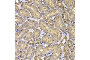 Immunohistochemistry of paraffin-embedded mouse kidney using FKBP6 antibody. (FKBP6 抗体  (AA 1-327))