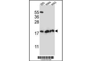 Western blot analysis in 293,Hela,K562 cell line lysates (35ug/lane). (DHFRL1 抗体  (AA 45-74))