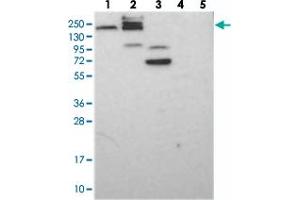 Western blot analysis of Lane 1: RT-4, Lane 2: U-251 MG, Lane 3: Human Plasma, Lane 4: Liver, Lane 5: Tonsil with GEMIN5 polyclonal antibody  at 1:250-1:500 dilution. (GEMIN5 抗体)