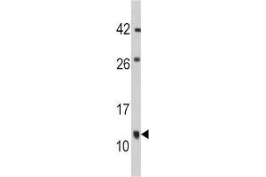 Western Blotting (WB) image for anti-FK506 Binding Protein 1B, 12.6 KDa (FKBP1B) antibody (ABIN3003540) (FKBP1B 抗体)