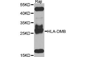 Western blot analysis of extracts of Raji cells, using HLA-DMB antibody. (HLA-DMB 抗体)