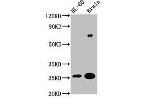 Western Blot Positive WB detected in: HL60 whole cell lysate, Rat brain tissue All lanes: FEV antibody at 5. (FEV 抗体  (AA 1-97))