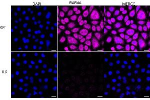 anti-RAB4A, Member RAS Oncogene Family (RAB4A) antibody