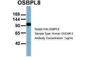 Host:  Rabbit  Target Name:  OSBPL8  Sample Type:  OVCAR-3  Antibody Dilution:  1. (OSBPL8 抗体  (Middle Region))