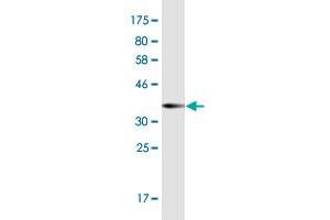 Western Blot detection against Immunogen (36. (POTEH 抗体  (AA 189-288))