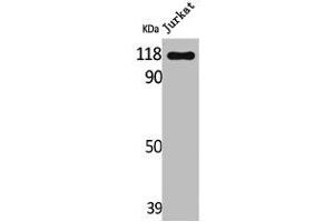 Western Blot analysis of Jurkat cells using Lfc Polyclonal Antibody (ARHGEF2 抗体)
