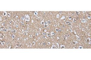 Immunohistochemistry of paraffin-embedded Human brain tissue using WIF1 Polyclonal Antibody at dilution of 1:100(x200) (WIF1 抗体)