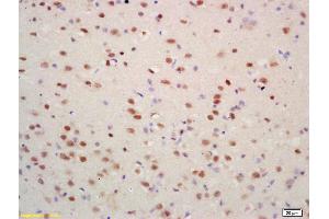 Formalin-fixed and paraffin embedded rat brain labeled with Rabbit Anti Acetyl-Histone H4(K16) Polyclonal Antibody, Unconjugated (ABIN1387532) at 1:200 followed by conjugation to the secondary antibody and DAB staining