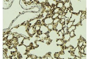 ABIN6268983 at 1/100 staining Mouse lung tissue by IHC-P. (ATRIP 抗体  (pSer224))