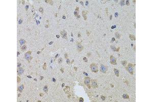 Immunohistochemistry of paraffin-embedded Mouse brain using ITGB8 Polyclonal Antibody at dilution of 1:100 (40x lens). (ITGB8 抗体)